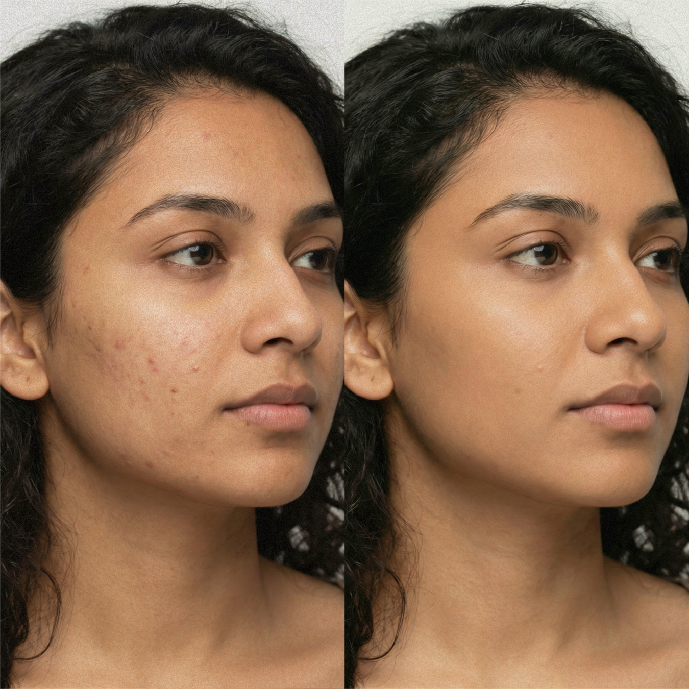 AMAZINGCONCEALER